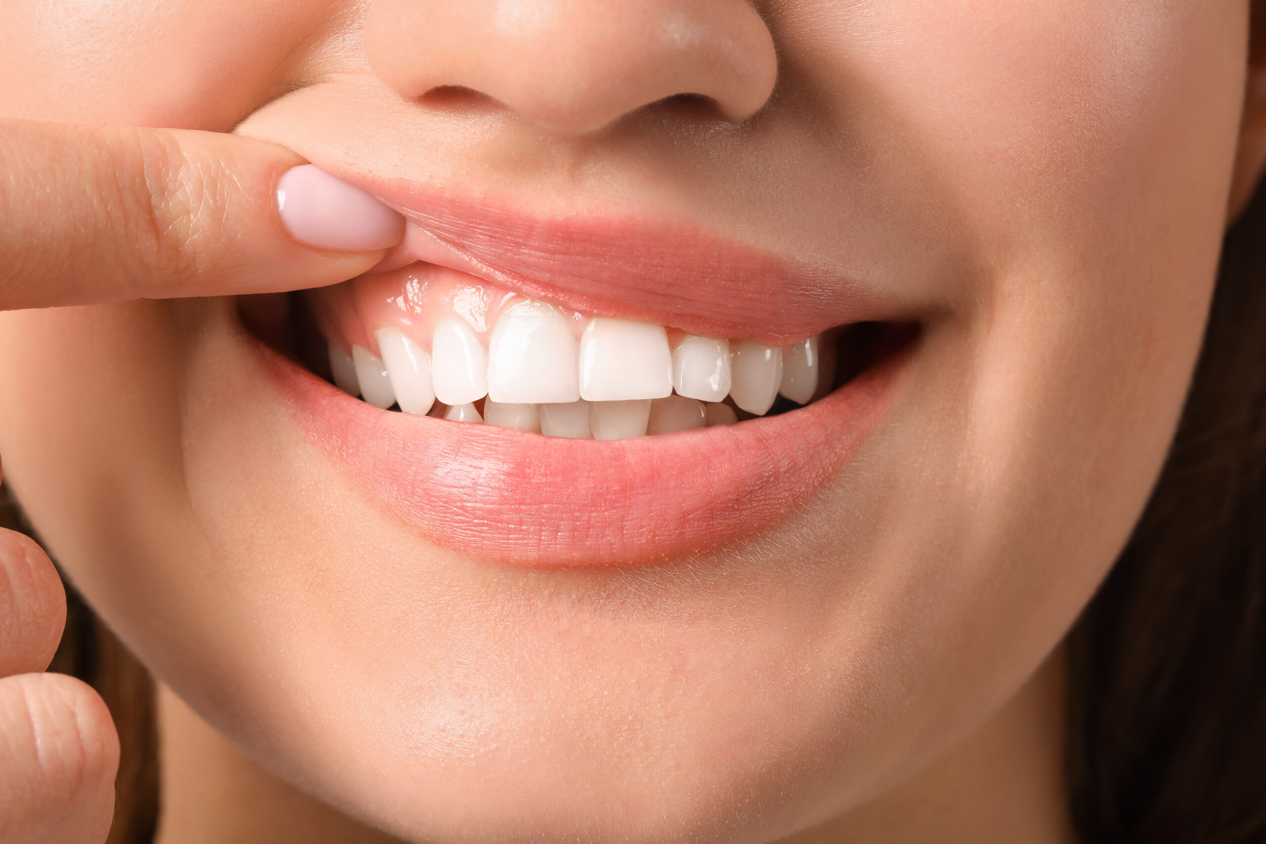 young woman with healthy gums closeup