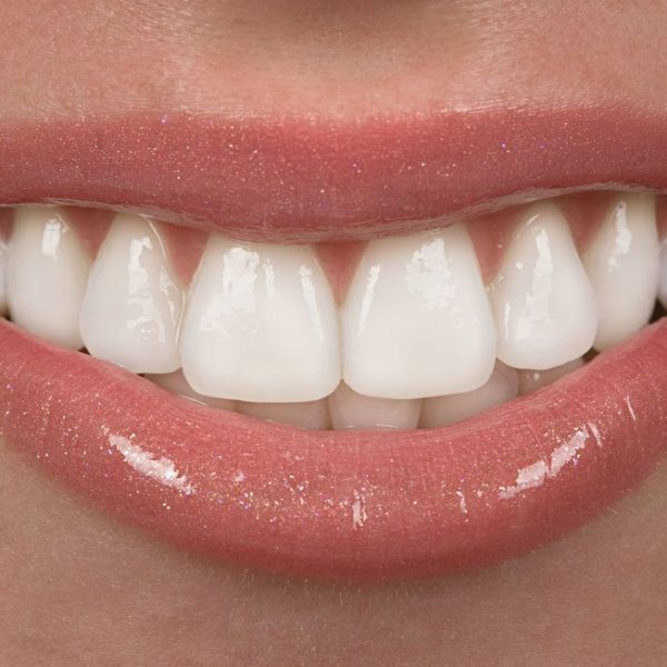 Close-up of a smiling mouth