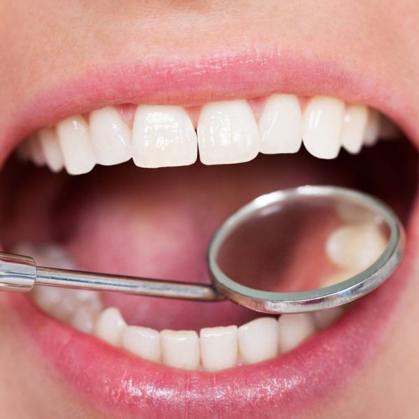 Dental examination with mirror and tools